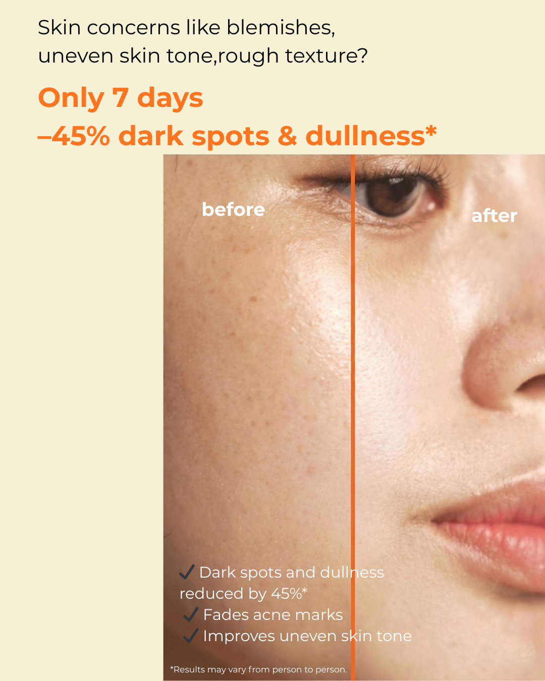 innisfree - Vitamin C Green Tea Enzyme Brightening Serum - 30ml