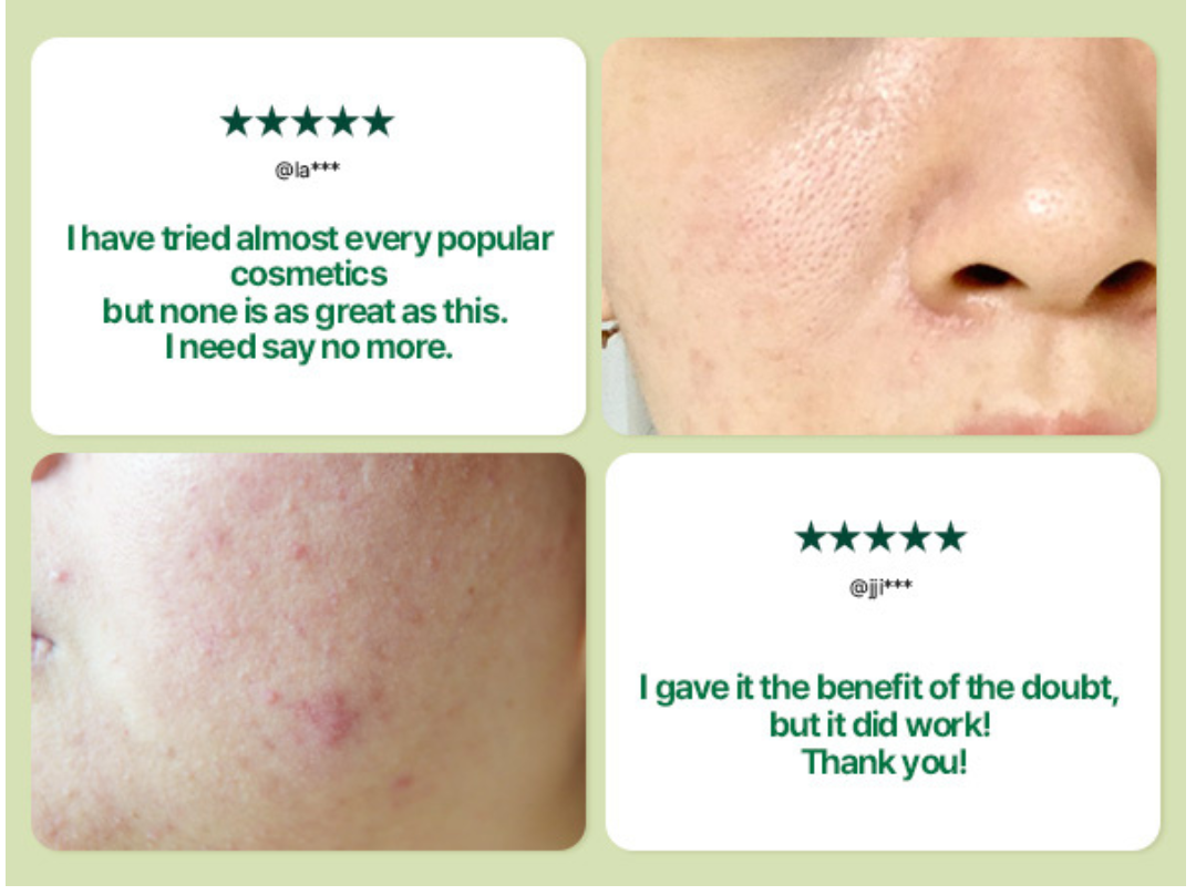 Pyunkang Yul - Ultimate Calming Solution Ampoule - 30ml