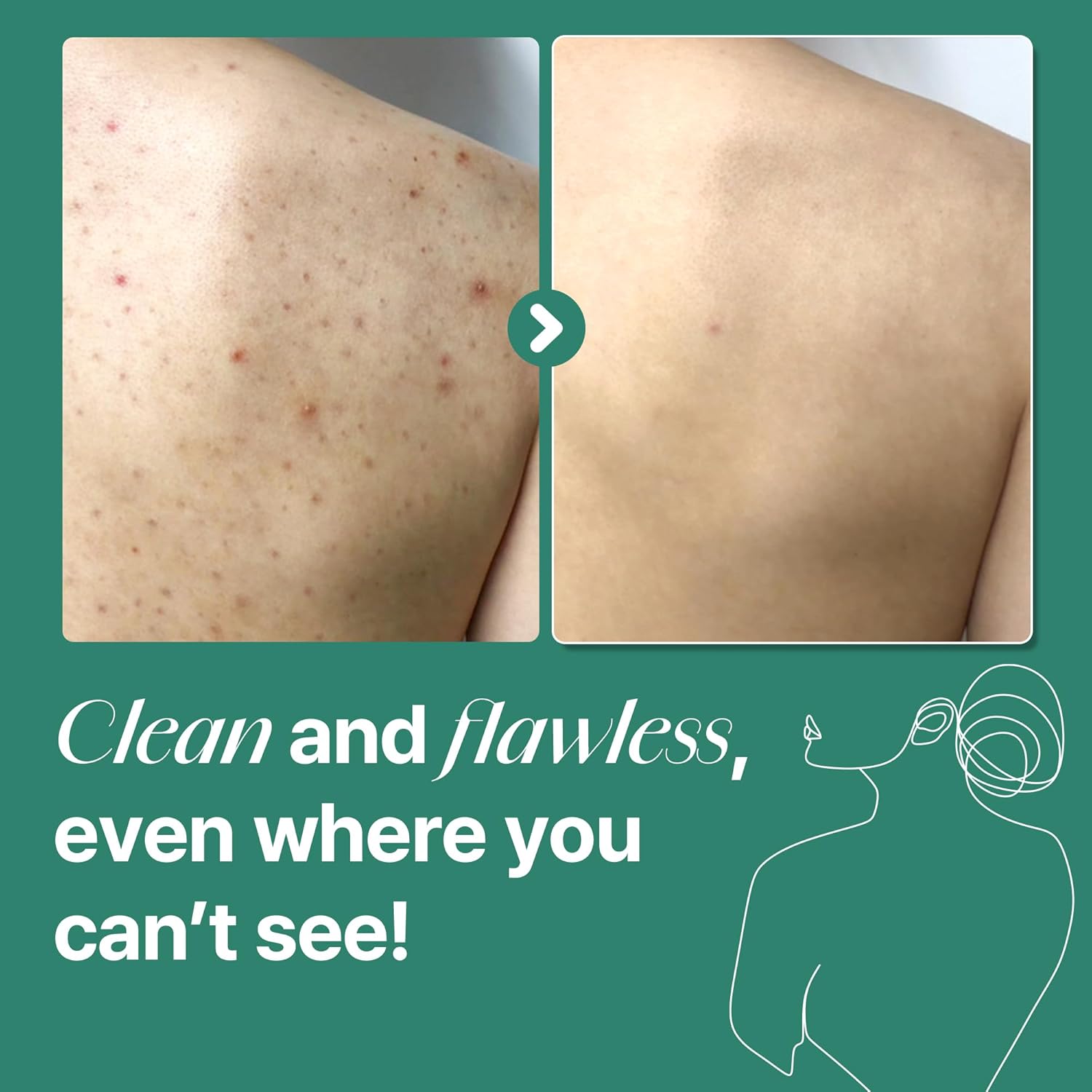 SOME BY MI Aha Bha Pha Miracle Acne Clear Body Cleanser