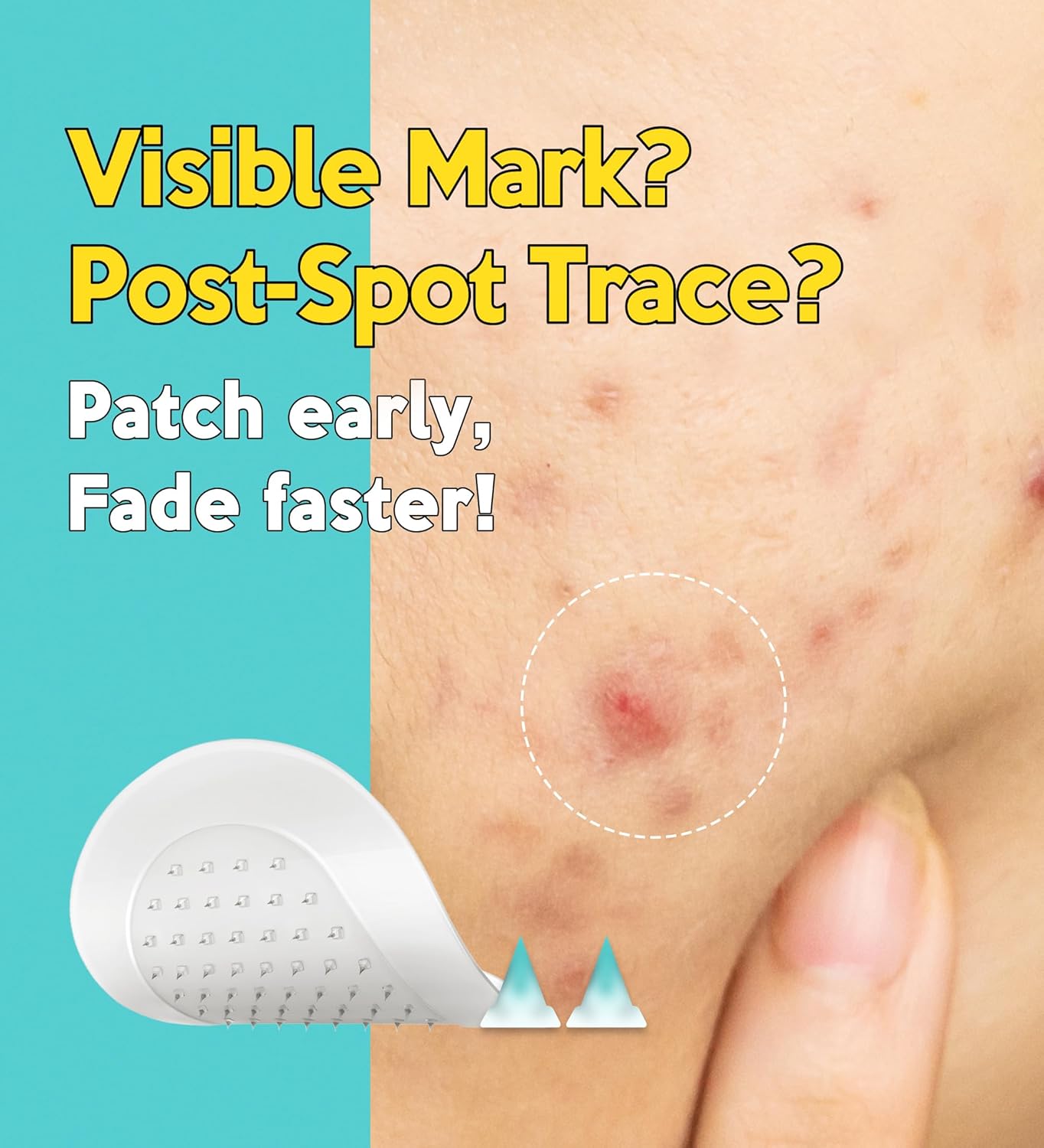 Troubless - Micro-Point Patch Plus Vitamin C 10% For Dark Spot - 9pcs