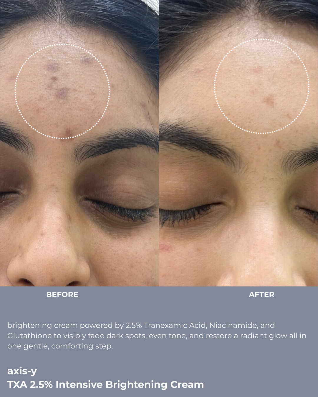 AXIS-Y - TXA 2.5% Intensive Brightening Cream - 50ml