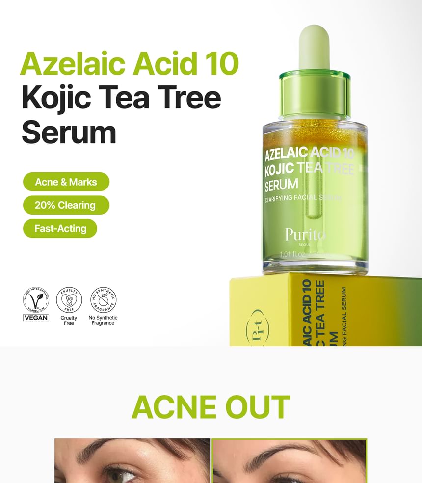 Purito SEOUL - Azelaic Acid 10 Kojic Tea Tree Serum - 30ml