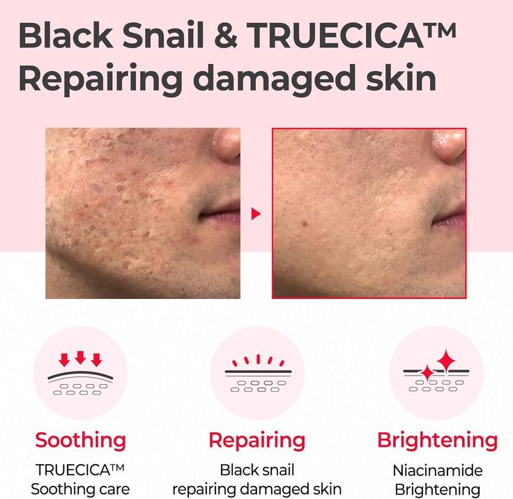 SOME BY MI Snail Truecica Repair Toner 150ml