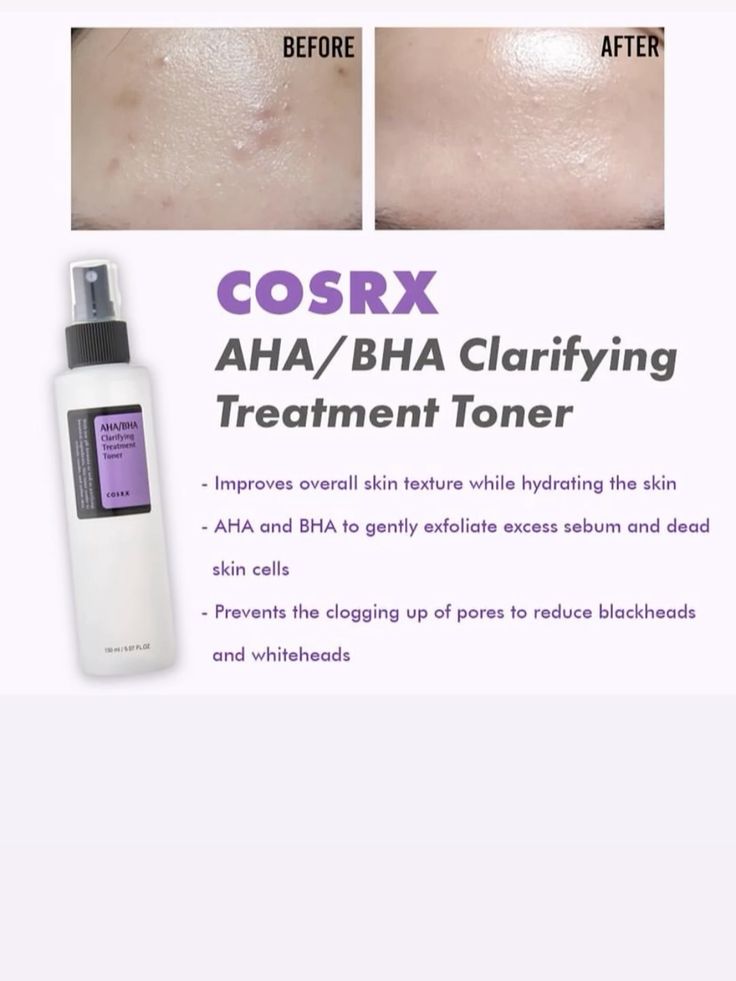 COSRX AHA/BHA Clarifying Treatment Toner 150ml
